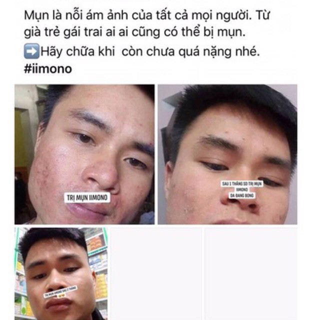 Combo 3 hộp tinh chất mụn IIMONO 6ml | BigBuy360 - bigbuy360.vn