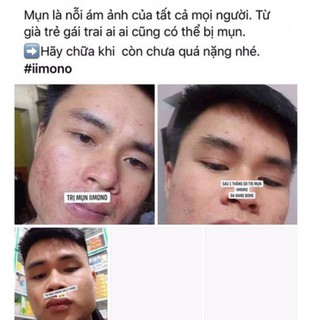 Combo 3 hộp tinh chất mụn IIMONO 6ml
