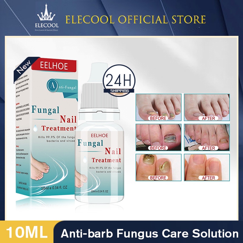 Eelhoe 10ml Nail sửa chữa nuôi dưỡng giữ ẩm chống-barb nấm giải pháp chăm sóc