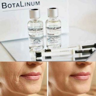 Botalium giúp giảm nhăn, căng bóng da, trẻ hóa làn da