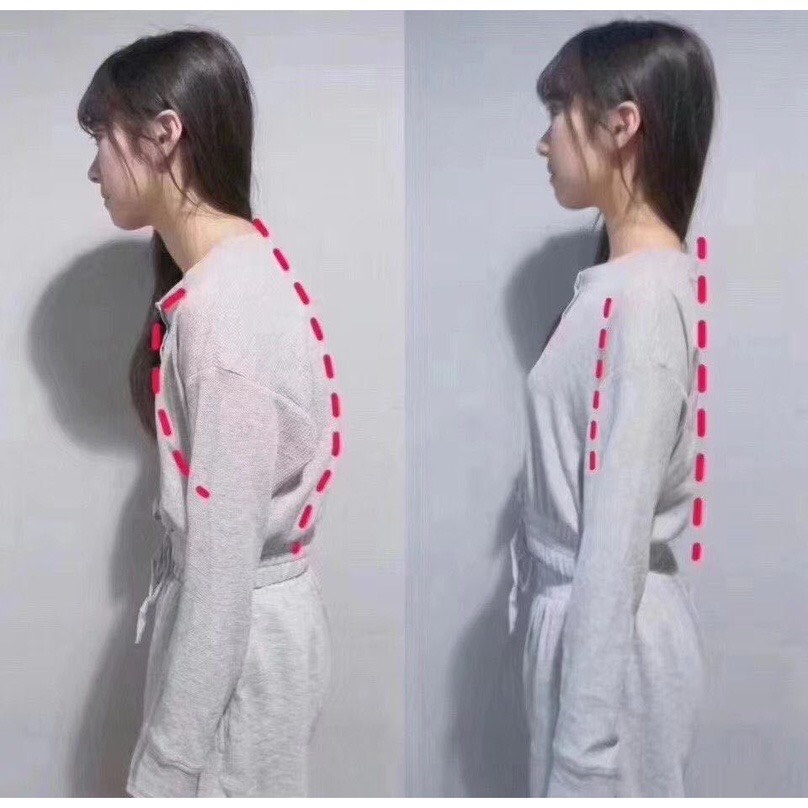 Áo lót nữ su đúc chống gù lưng, Không Gọng, Mút Mỏng CAO CẤP