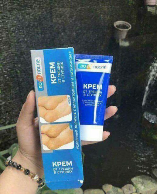 Kem trị nứt nẻ chân Nga BQ | BigBuy360 - bigbuy360.vn