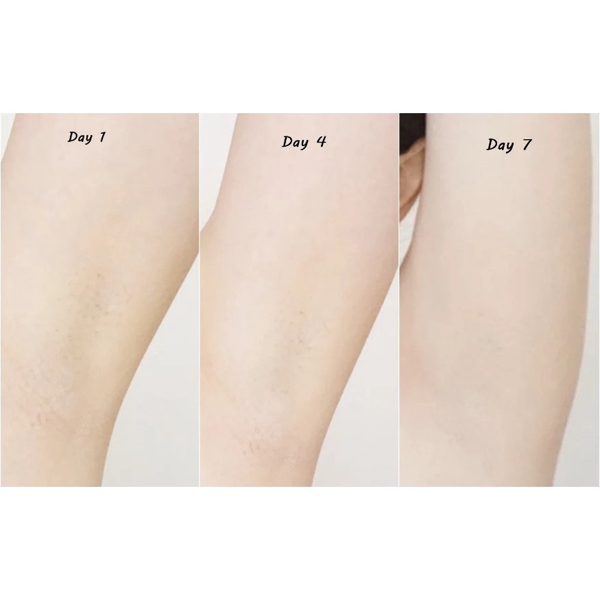 Tinh Chất Dưỡng Trắng Khử Mùi 48h Vùng Dưới Cánh Tay Vaseline Dry Serum Thái Lan 50ml