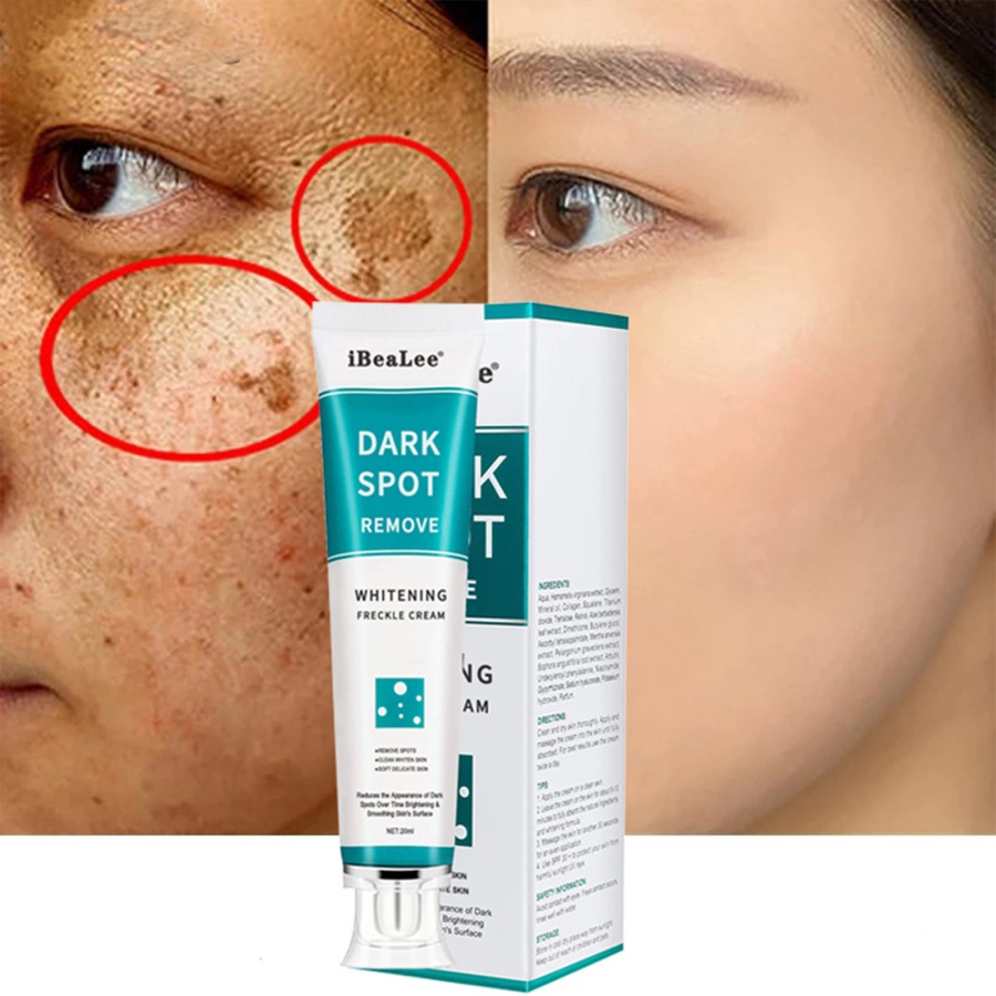 Kem Dưỡng Ẩm Làm Trắng Xóa Đốm Nâu Hiệu Quả 20ml