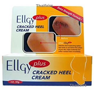Kem trị nứt gót chân Ellgy