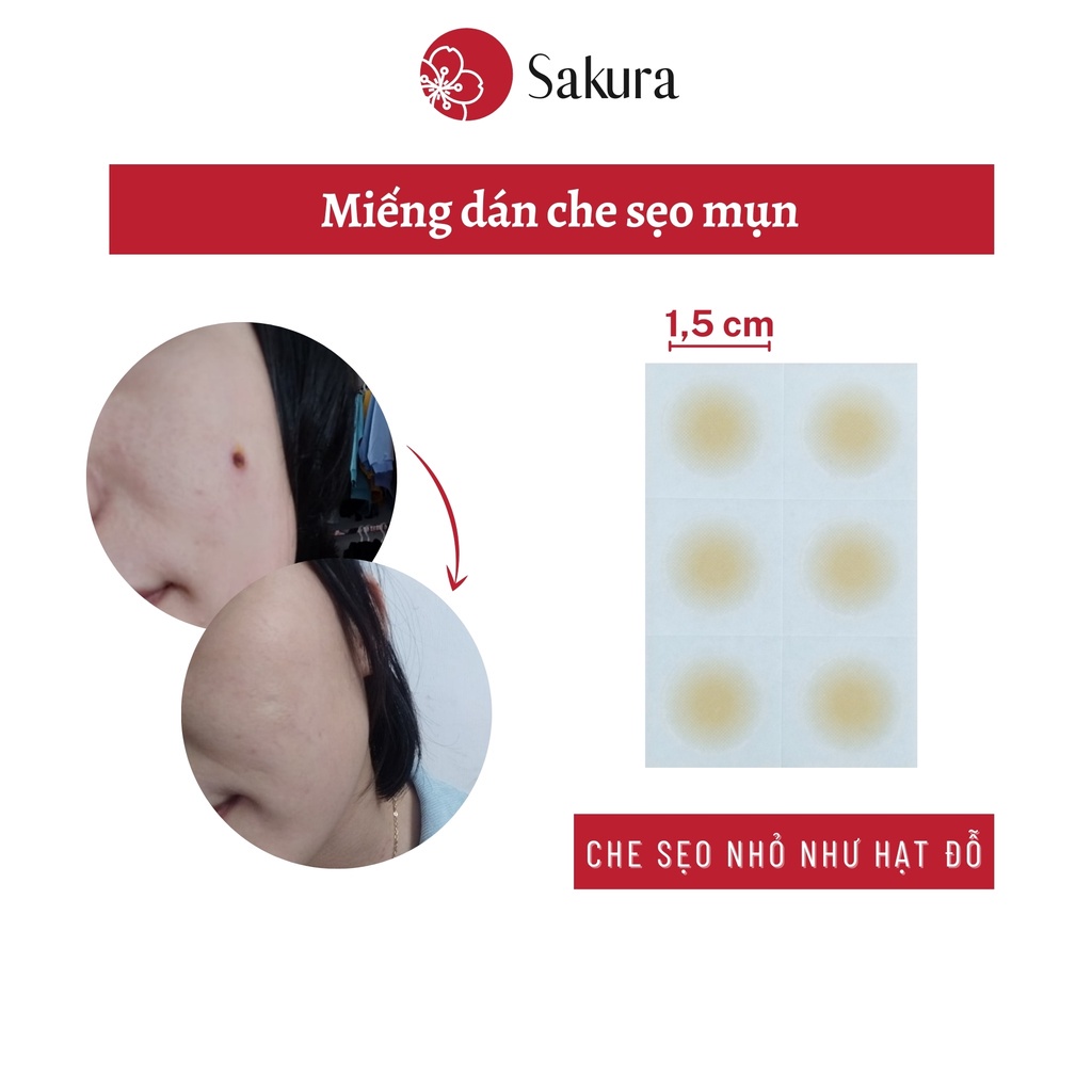 Miếng dán che sẹo mụn Japan Sakura 1.5cm che nốt ruồi che khuyết điểm nhiều màu chống nước, nhiều size
