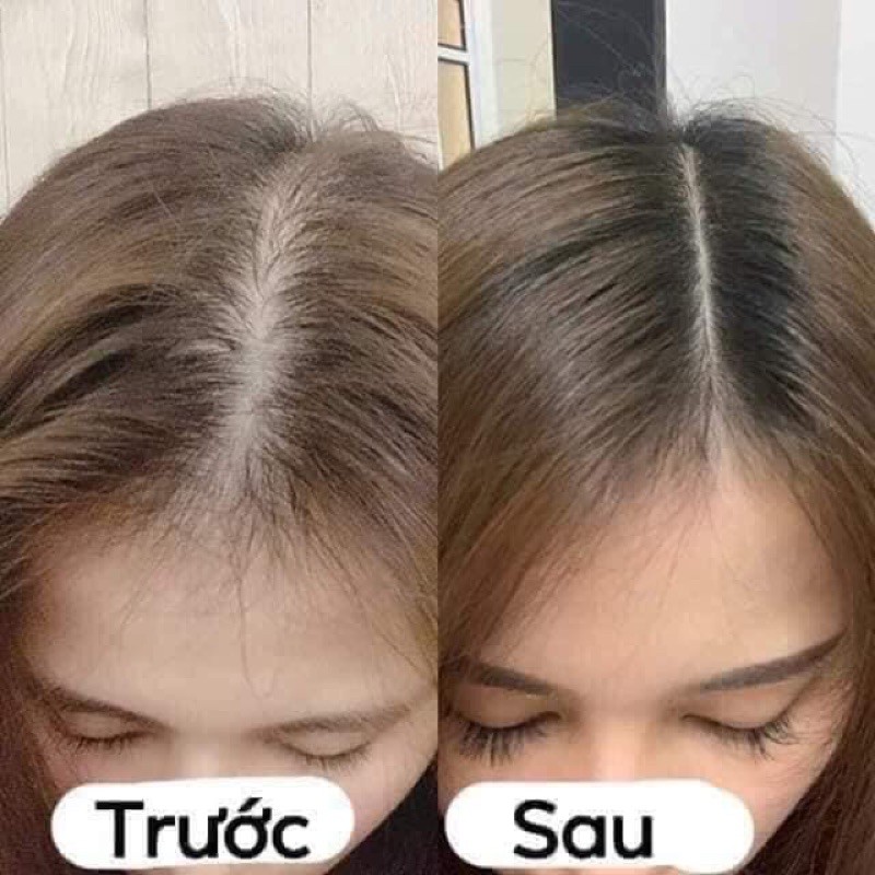 Tinh Dầu Bưởi VIJULLY [Kích Mọc Tóc] 100% Tự Nhiên | BigBuy360 - bigbuy360.vn