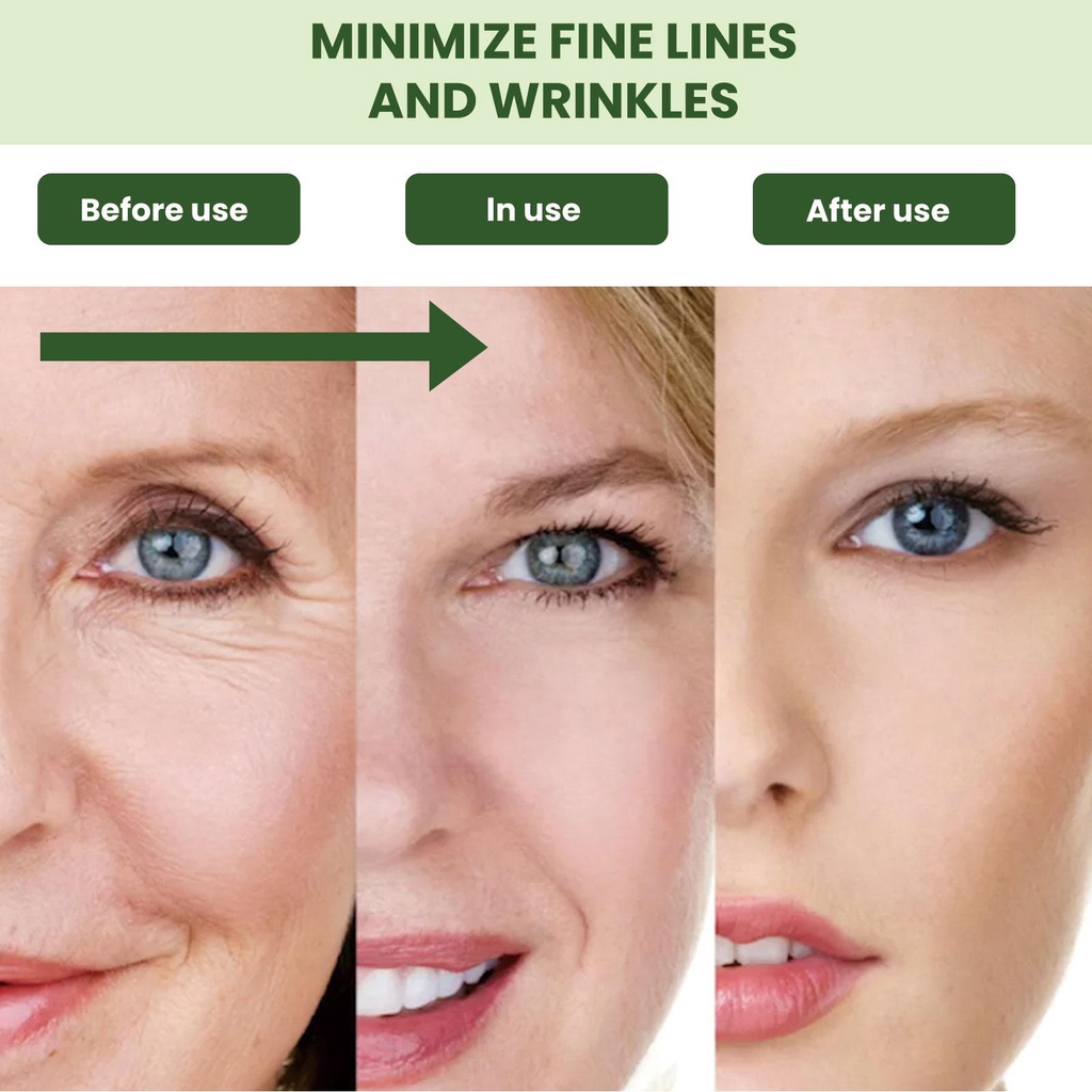 Tinh Chất Retinol Collagen Chống Lão Hóa Loại Bỏ Nếp Nhăn Chăm Sóc Da X0O3