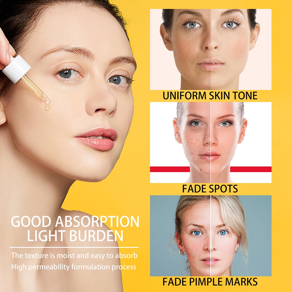 Vitamin C Phai Tại Chỗ Huyết Thanh Giữ Ẩm Tại Chỗ Loại Bỏ Mụn Trứng Cá Sáng Da Toneserum