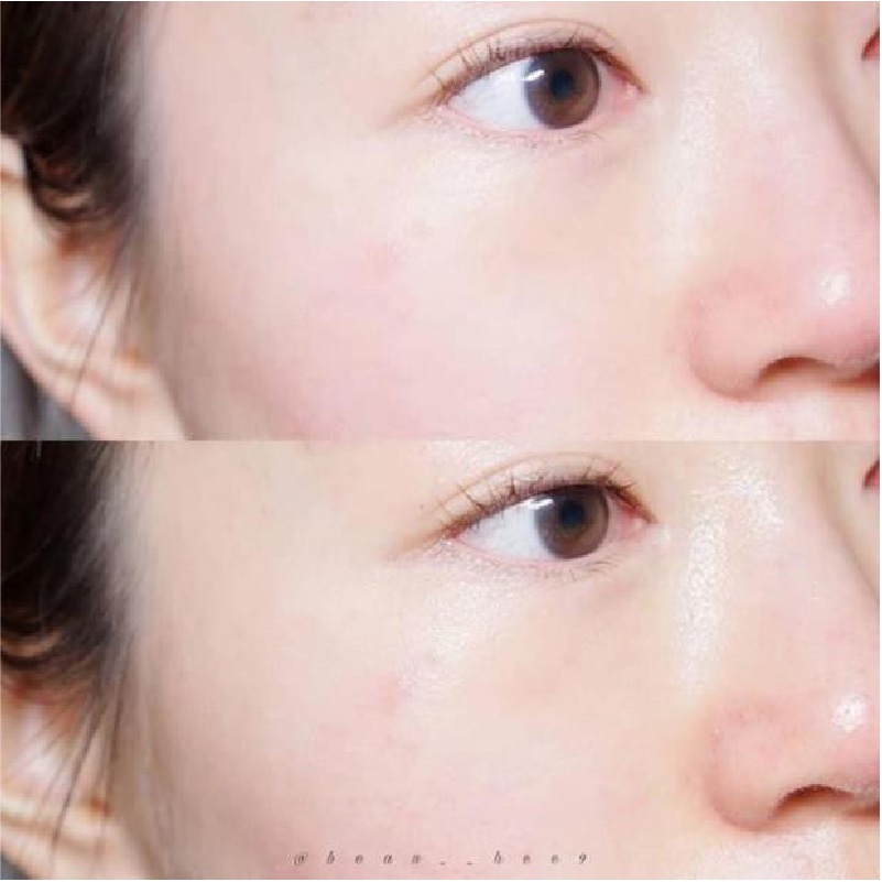 Kem Chống Nhăn và giảm Thâm Quầng Mắt AHC ULTIMATE REAL EYE CREAM | BigBuy360 - bigbuy360.vn