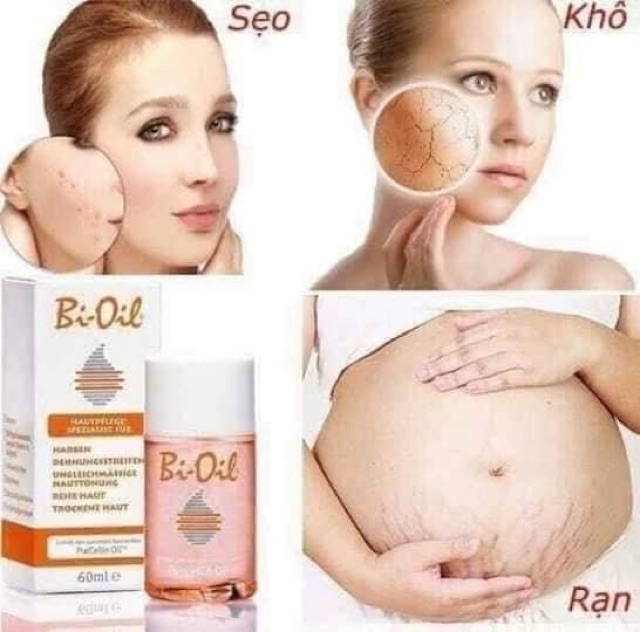 Kem bôi rạn da Bio - Oil 60ml/125ml/200ml.