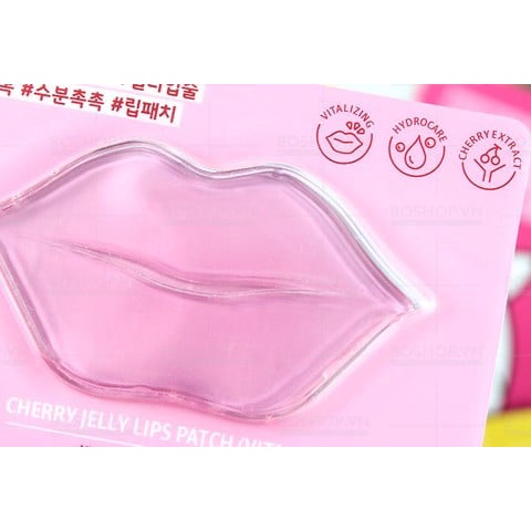 Mặt Nạ Dưỡng Ẩm Hồng Môi ETUDE HOUSE Cherry Jelly Lips Patch (Vitalizing)