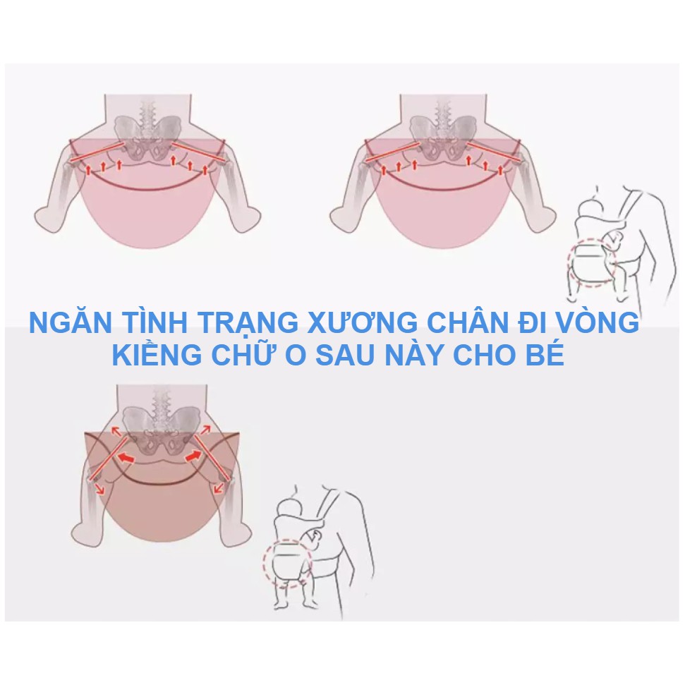 Địu lưới thoáng khí cho em bé Aingtree chống gù