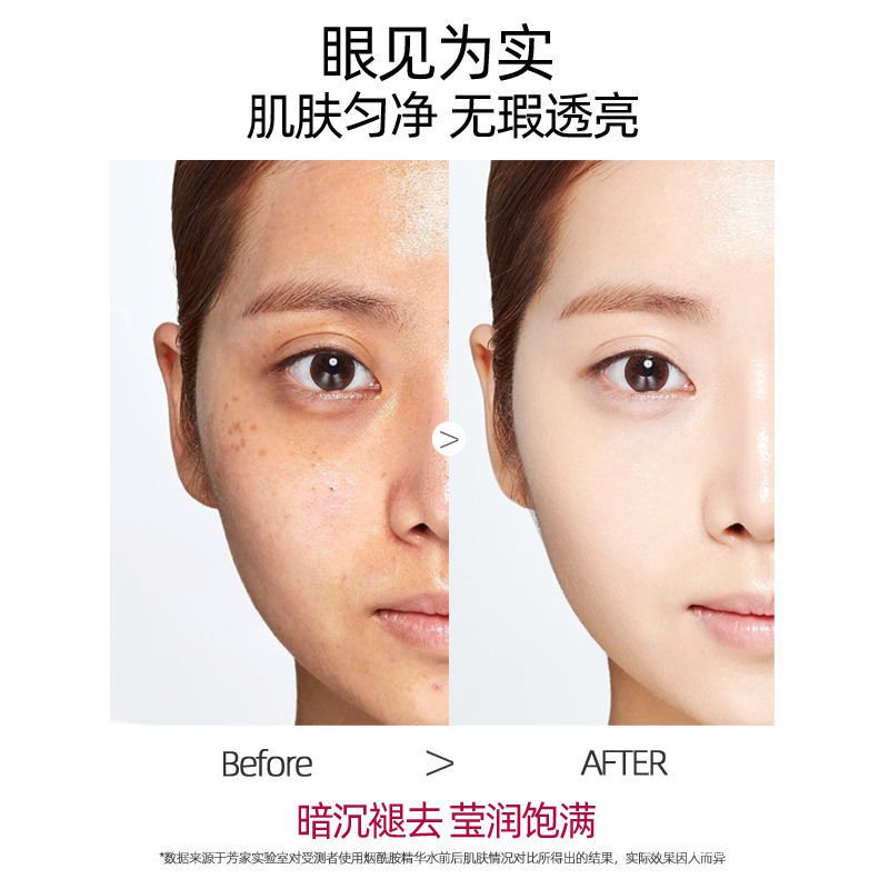 (Giới Hạn Thời Gian Đặc Biệt)Niacinamide Làm Trắng Kết Hợp Dưỡng Ẩm Màu Vàng Để Melanin Ánh Sáng Làm Sáng Màu Da Kem Chăm Sóc Da Sinh Viên