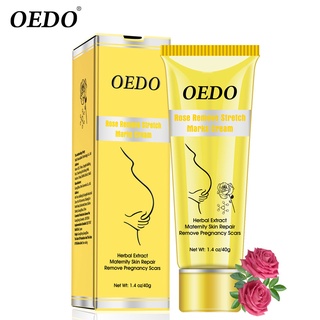 Kem trị rạn da oedo cao cấp