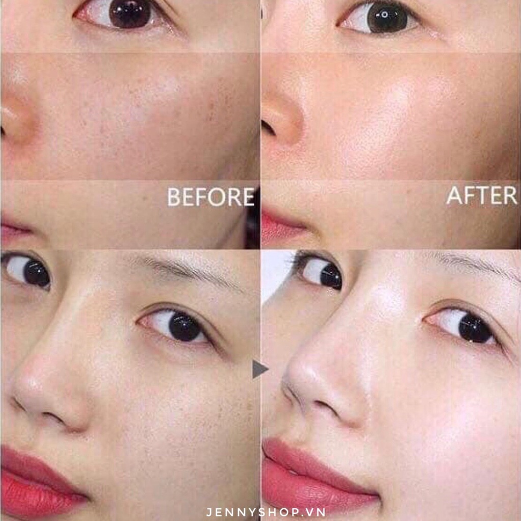 Kem Dưỡng Mờ Nám Dongsung Rannce Cream