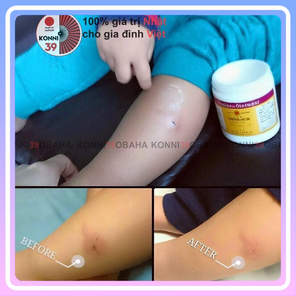 Kem bôi lành vết thương Oronine H Ointment 30g