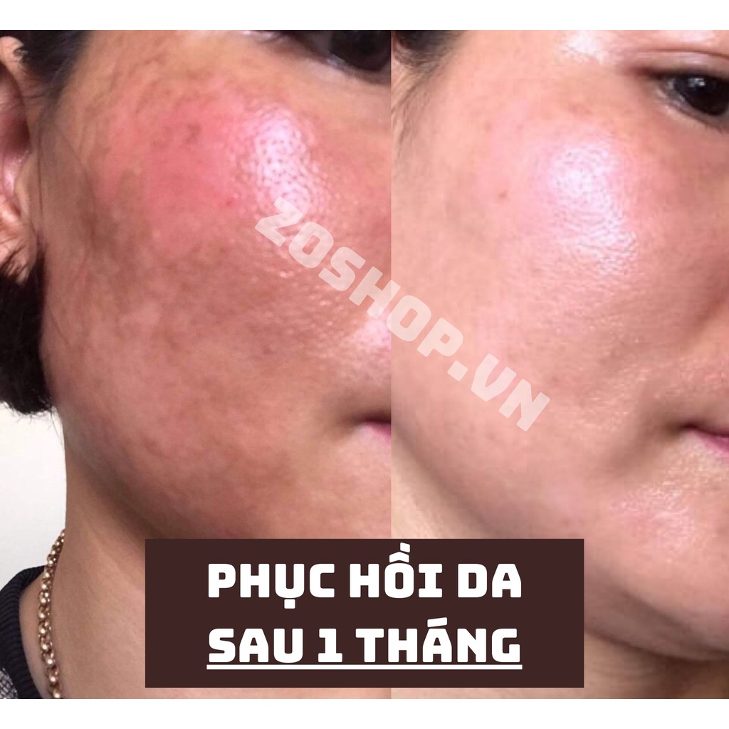 Set phục hồi chuyên sâu Meishoku Repair &amp; Balance Mild Lotion &amp; Cream