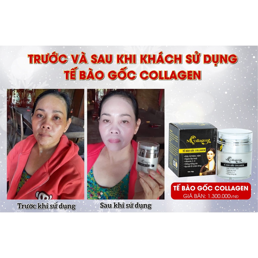 Kem Tế Bào Gốc Cao Cấp N'Collagen - Hỗ trợ giảm ngay mụn, nám, đào thải sắc tố sạm đen 30g