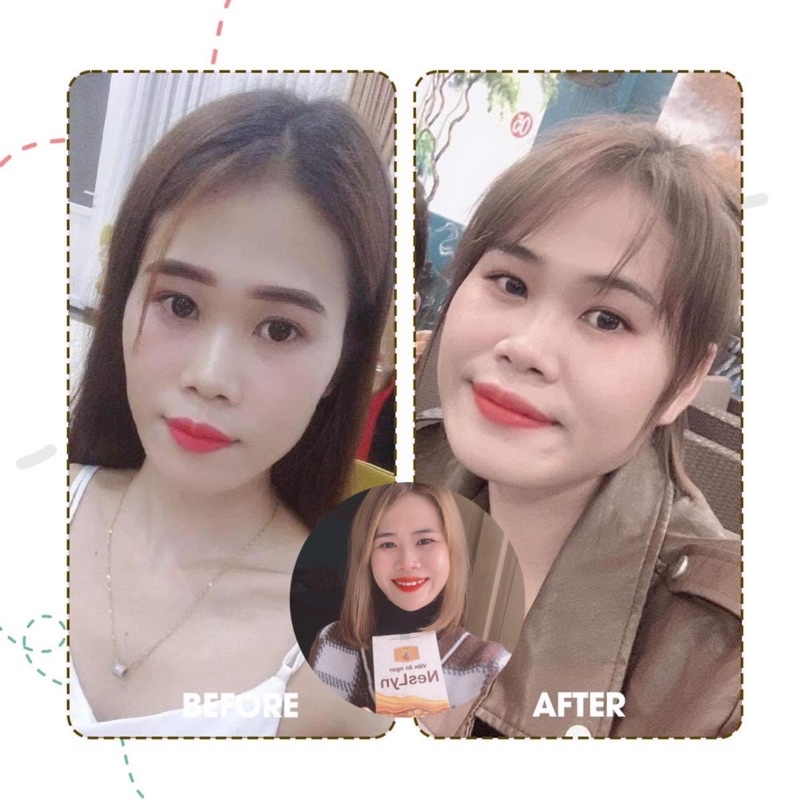 Viên ăn ngon NesLyn hỗ trợ tiêu hoá, giúp ăn ngon,ngủ ngon tăng cân