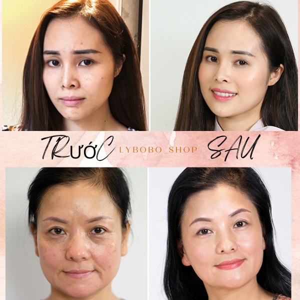 Vitamin E đỏ đẹp da chống lão hoá giảm sạm nám giảm nếp nhăn