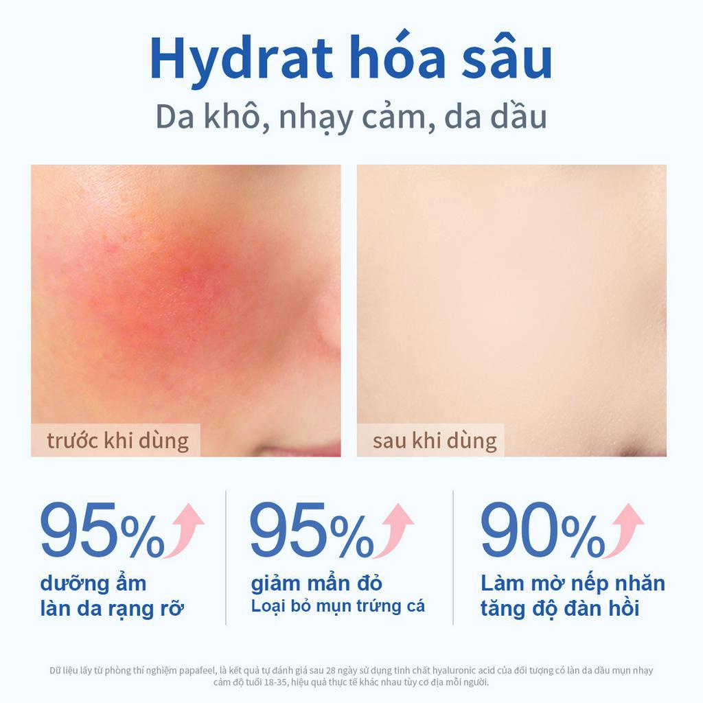 PAPA FEEL Serum cấp ẩm Da dưỡng ẩm/làm dịu Axit Hyaluronic 20ml