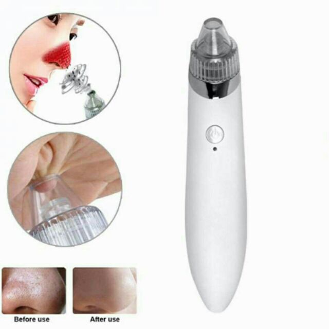 MÁY HÚT MỤN CẦM TAY BLACK HEAD DETECTOR KÈM 03 ĐẦU HÚT | BigBuy360 - bigbuy360.vn
