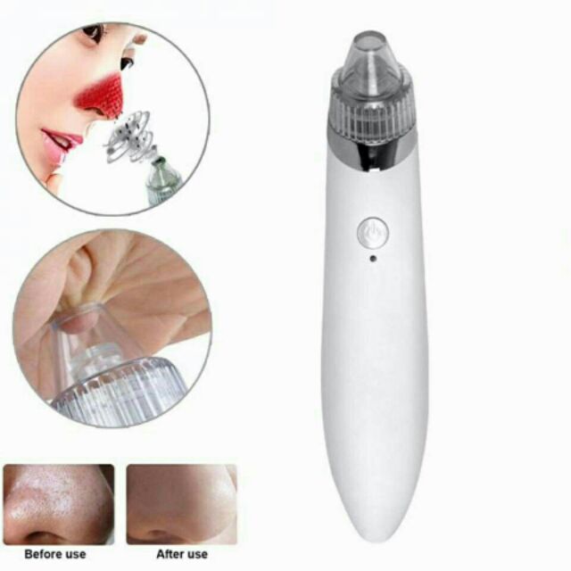 MÁY HÚT MỤN CẦM TAY BLACK HEAD DETECTOR KÈM 03 ĐẦU HÚT