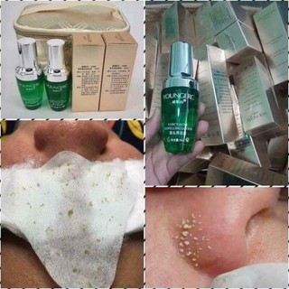 Ủ mụn Youngerc đầu đen, mụn cám Youngerc chai 30ml