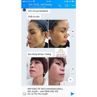 KEM TÁI TẠO DA CHAMOMILESKILL