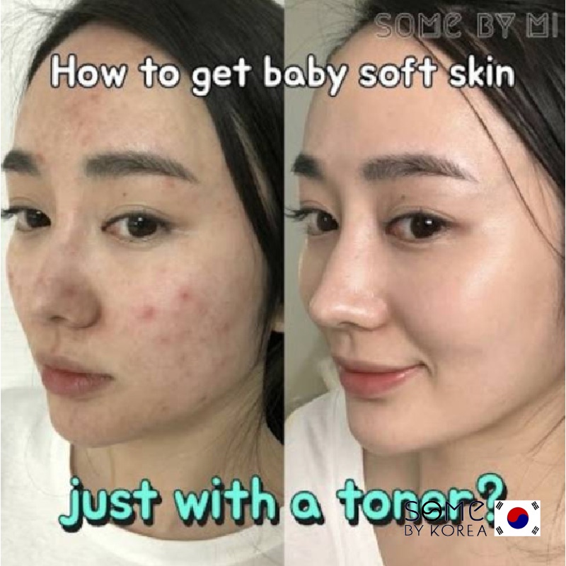 [CHÍNH HÃNG] Nước Hoa Hồng Giảm Mụn Some By Mi AHA-BHA-PHA 30 Days Miracle Toner Some By Me 150ml | BigBuy360 - bigbuy360.vn