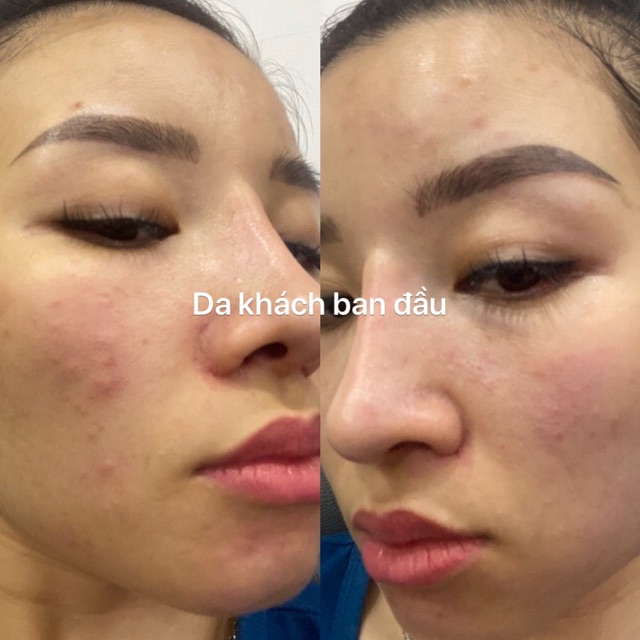 Serum caramel essence( 1 tuần dùng không hiệu quả được đổi trả hoàn tiền) | BigBuy360 - bigbuy360.vn