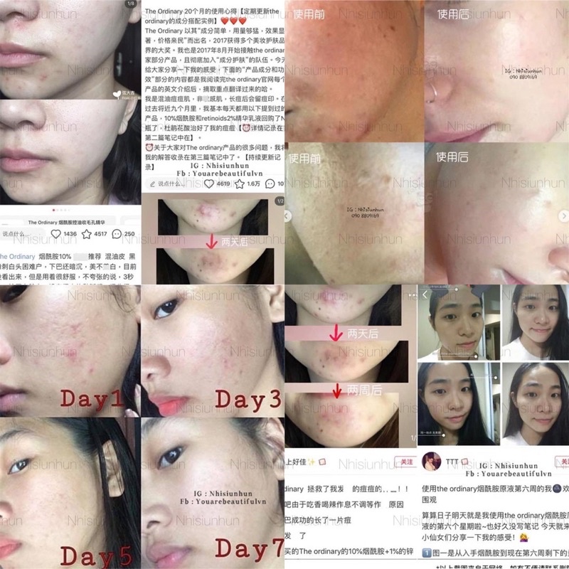 Serum The Ordinary Niacinamide 10% + Zinc 1%