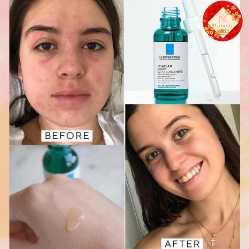 Serum GIẢM MỤN HIỆU QUẢ EFFACLAR ULTRA CONCENTRE LAROCHE POSSAY