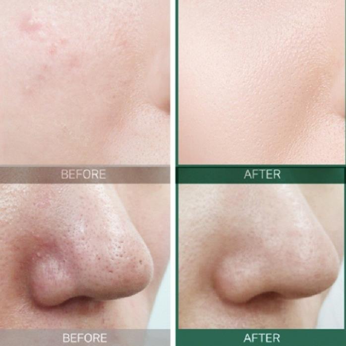 Serum Some By Mi AHA-BHA-PHA 30 Days Miracle Serum 50ml dành cho da mụn | BigBuy360 - bigbuy360.vn