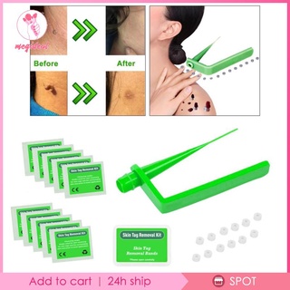 Bộ thiết bị Loại bỏ hiệu quả Chỉ 30 băng tần