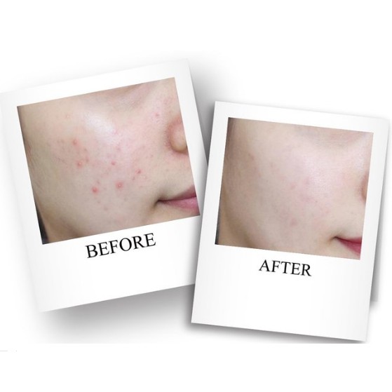 SEXYLOOK Mặt Nạ Tràm Trà Giảm Mụn Kiềm Dầu Dưỡng Ẩm (miếng lẻ) Sexy Look Mask [BẢN ĐÀI CHÍNH HÃNG] | BigBuy360 - bigbuy360.vn
