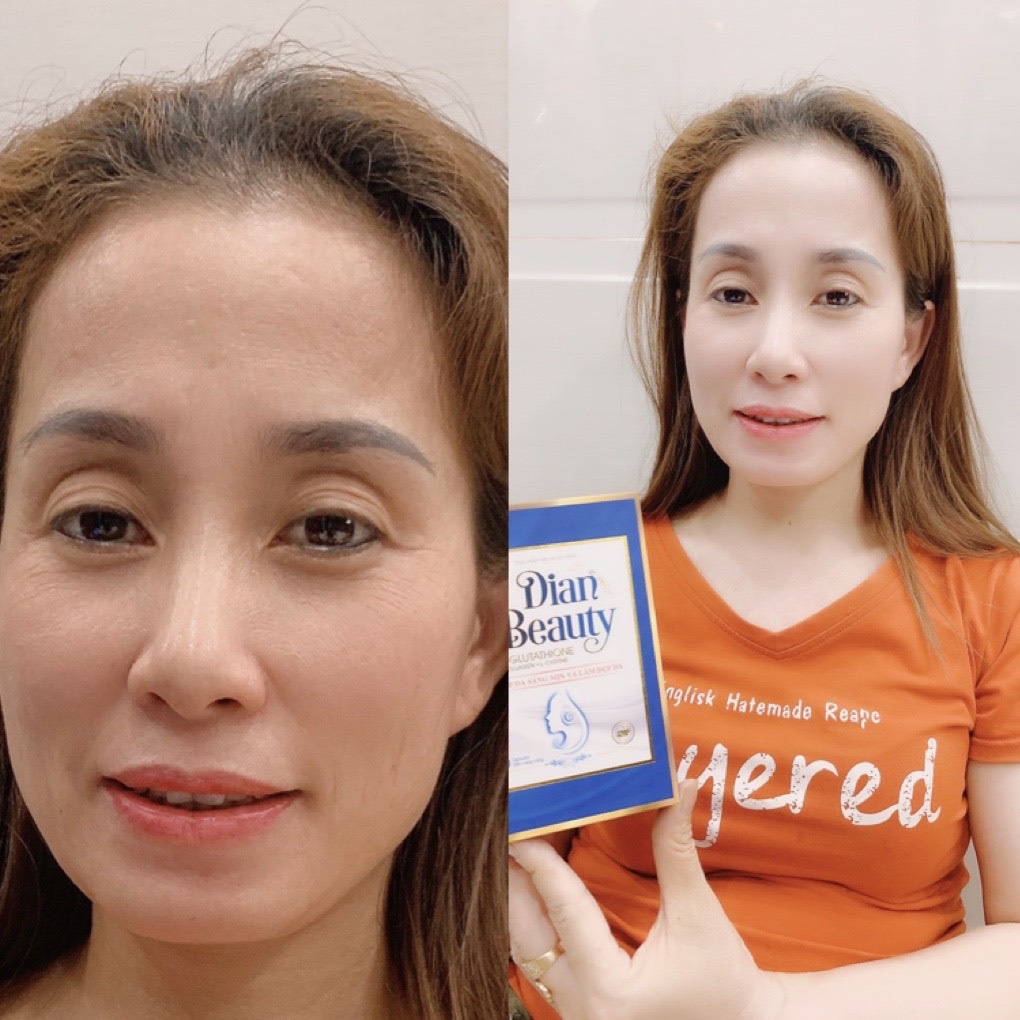 Viên Uống Trắng Da Dian Beauty, [Mua 1 Tặng 2] ,Mua 2 Giảm thêm 59K, FreeShip, Trắng toàn thân, mờ nám | Thế Giới Skin Care