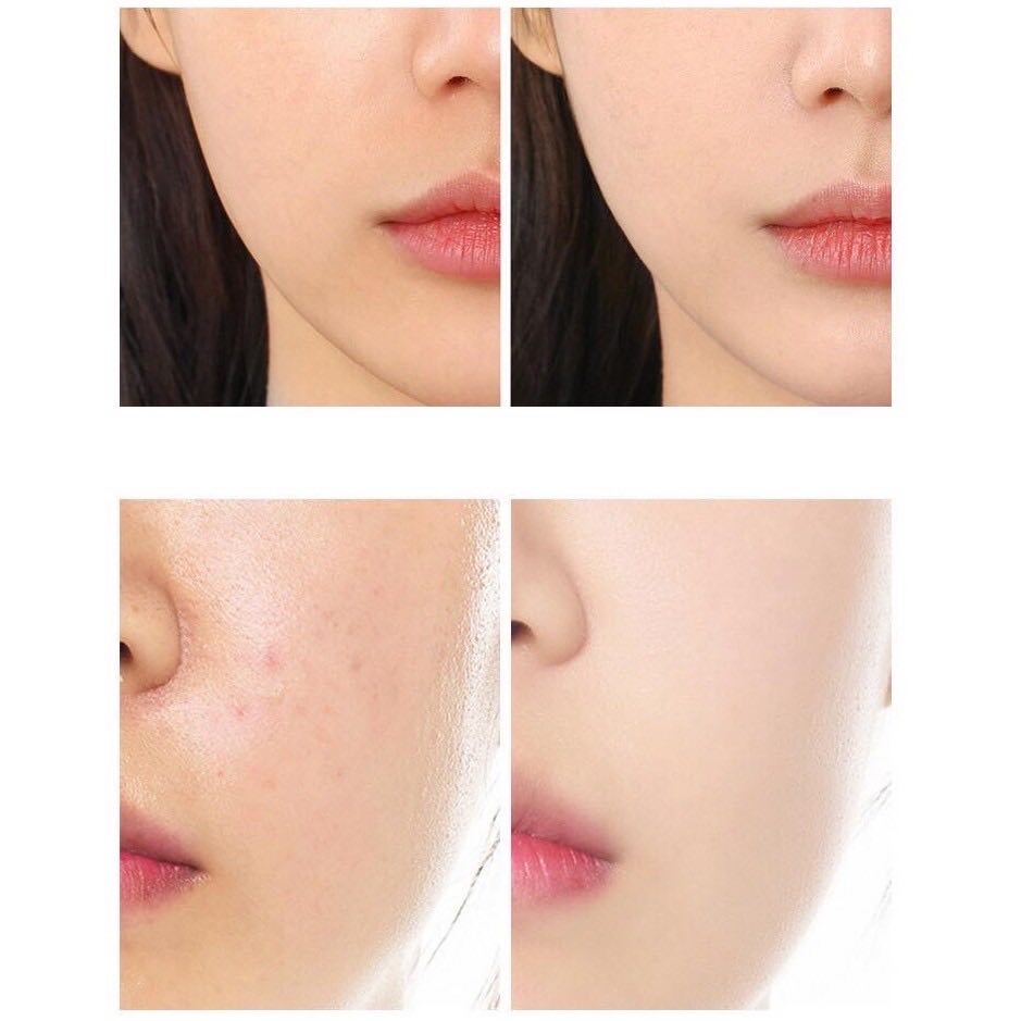 MẶT NẠ LÁ TÍA TÔ DƯỠNG SÁNG DA TRẮNG MỊN RẠNG RỠ