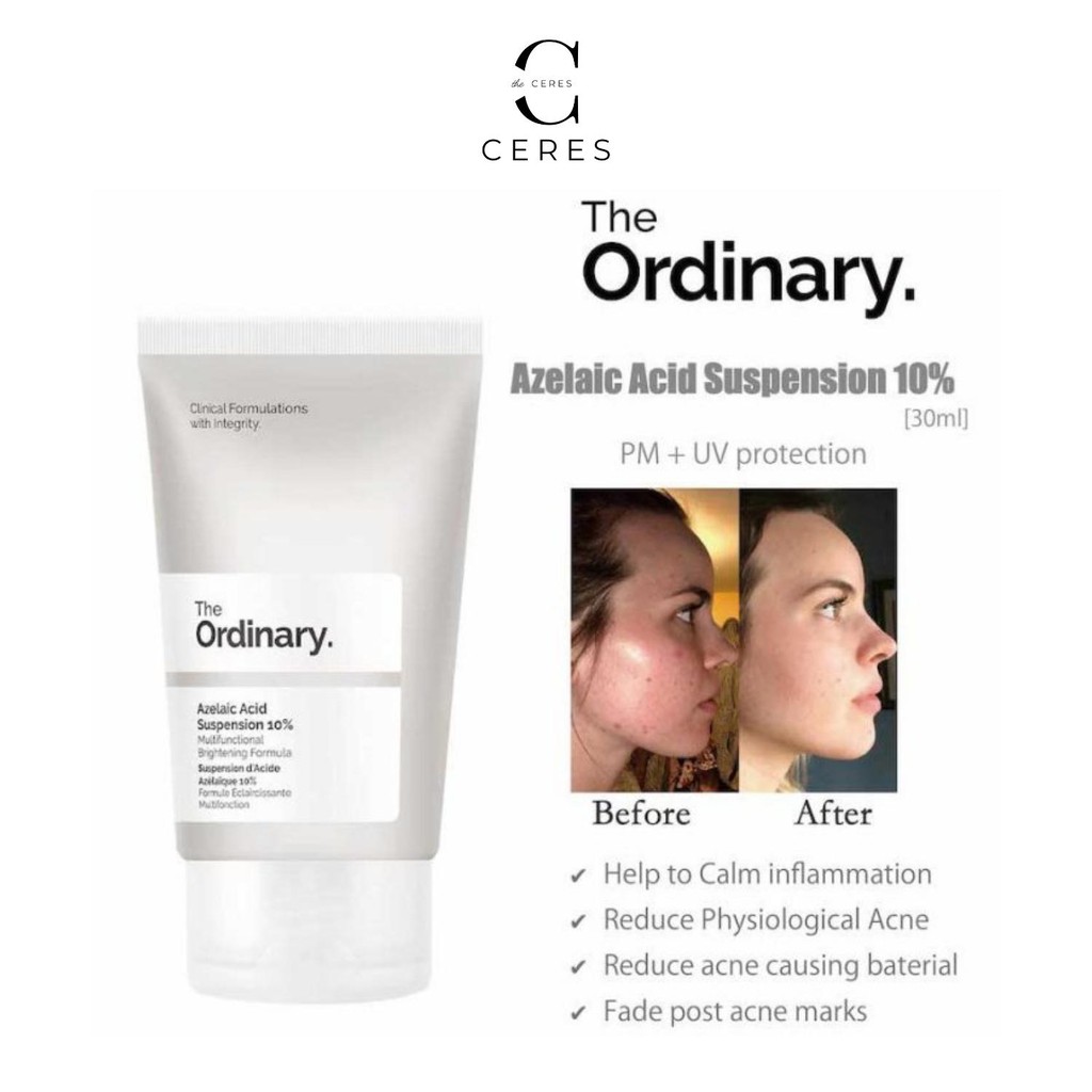 Kem Dưỡng Da Azelaic Acid Suspension 10% Sáng Da Tẩy Tế Bào Chết 30ml - The Ordinary