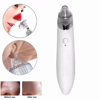 Máy hút mụn công nghệ mới