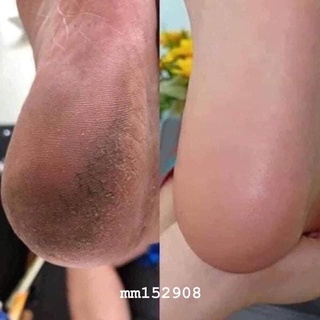 [Tặng kem dưỡng] CHÀ GÓT CHÂN TỰ ĐỘNG