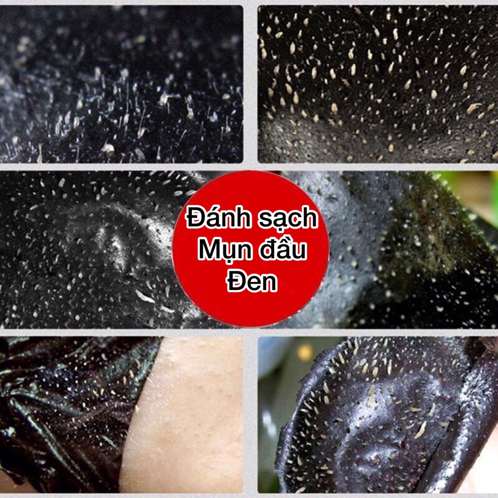 Gel lột mụn đầu đen 3 trong 1 mới