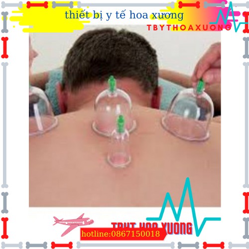Bộ Giác Hơi Không Cần Lửa 12 Ly Kèm 1 Ống Bơm Chuyên Dụng-thietbiytehoaxuong