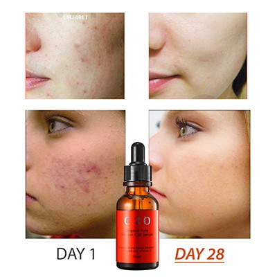 Serum Trắng Da Pure Vitamin C 21.5