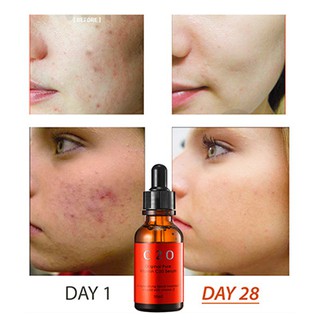 OST Pure Vitamin C 21.5 Advanced Serum