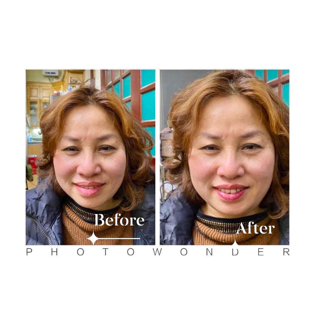 Dưỡng Phisolab Kích Màu Môi Sau Phun - Hàn Quốc Chuyên Dùng Sau Phun Xăm Thẩm Mỹ