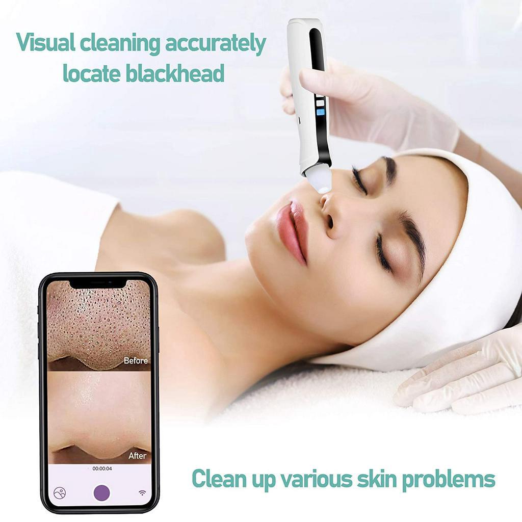 Bộ máy hút mụn đầu đen SUOLAER trực quan có đầu dò máy ảnh kết nối wifi làm sạch lỗ chân lông hiệu quả kèm phụ kiện