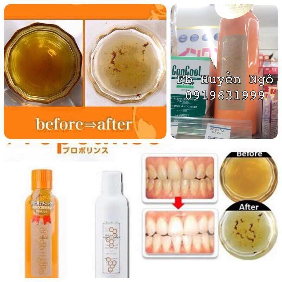 Nước súc miệng Propolinse