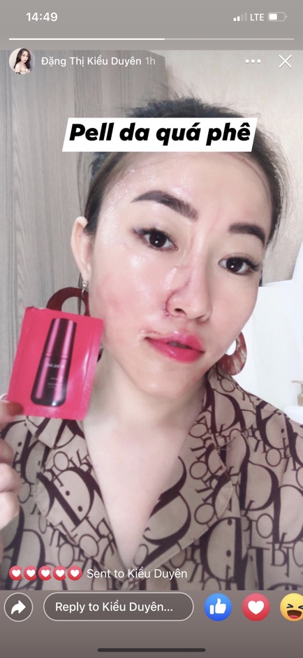 STING PEEL BE'BALANCE - TẨY DA CHẾT - GÓI NHỎ TIỆN LỢI | BigBuy360 - bigbuy360.vn